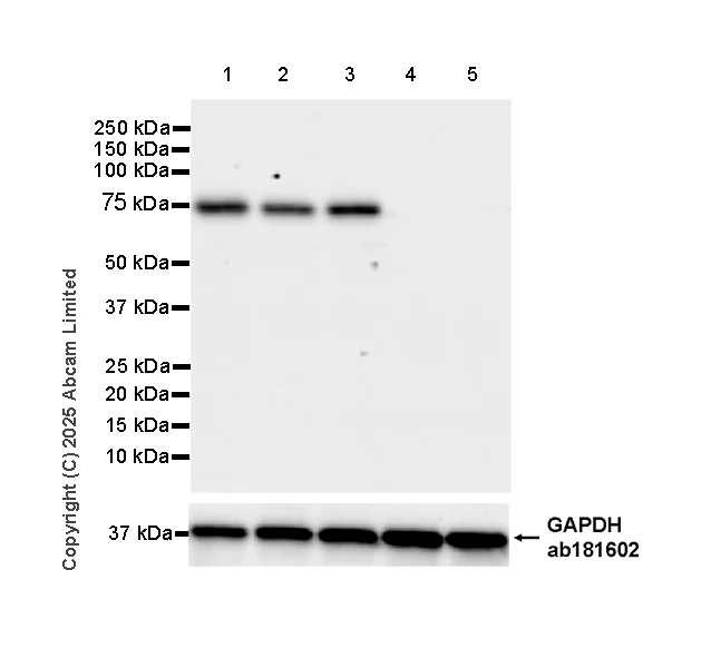 Western blot - Anti-Transglutaminase 2 antibody [EPR29853-527] - BSA and Azide free (AB323809)