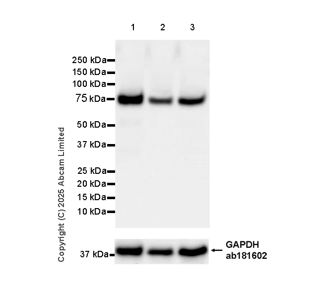 Western blot - Anti-Transglutaminase 2 antibody [EPR29853-527] - BSA and Azide free (AB323809)