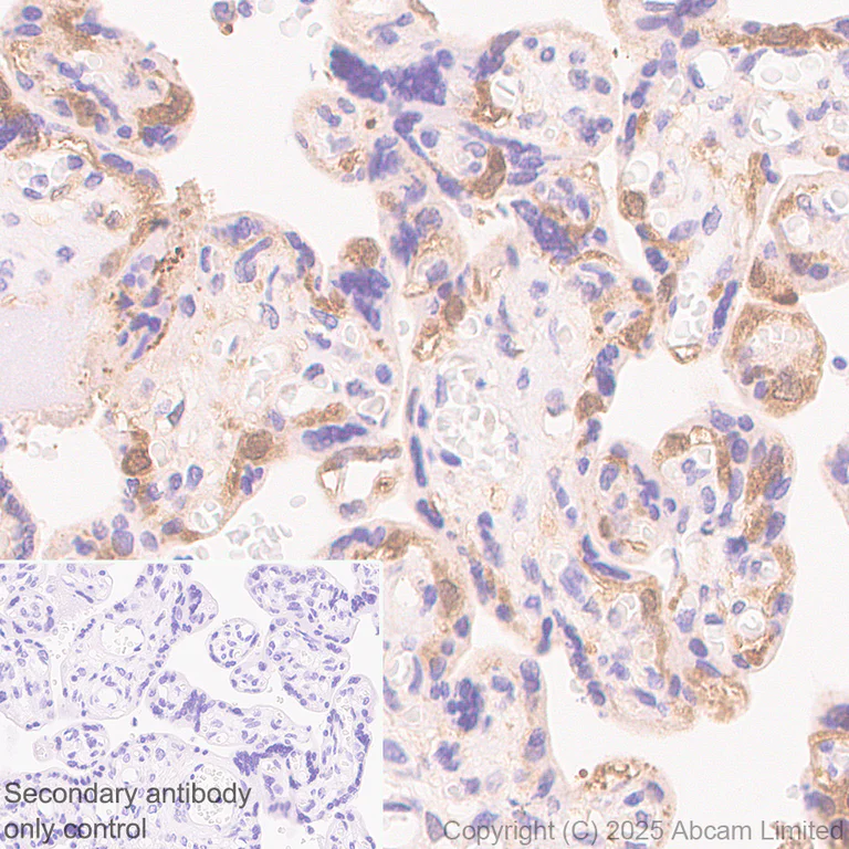 Immunohistochemistry (Formalin/PFA-fixed paraffin-embedded sections) - Anti-Transglutaminase 2 antibody [RM1361] (AB325401)