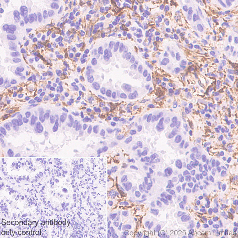 Immunohistochemistry (Formalin/PFA-fixed paraffin-embedded sections) - Anti-Transglutaminase 2 antibody [RM1361] (AB325401)