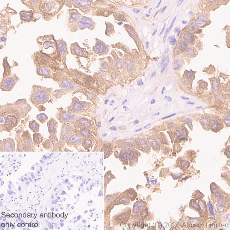 Immunohistochemistry (Formalin/PFA-fixed paraffin-embedded sections) - Anti-Transglutaminase 2 antibody [RM1361] (AB325401)