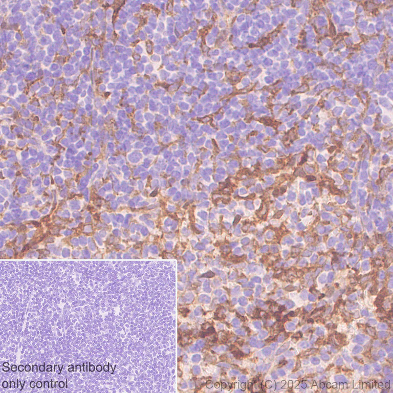 Immunohistochemistry (Formalin/PFA-fixed paraffin-embedded sections) - Anti-Transglutaminase 2 antibody [RM1361] (AB325401)