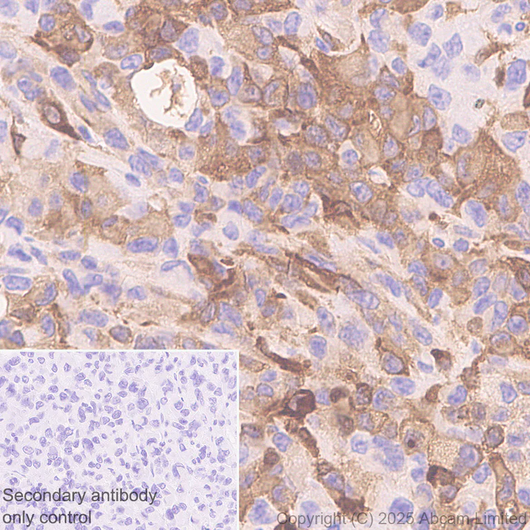 Immunohistochemistry (Formalin/PFA-fixed paraffin-embedded sections) - Anti-Transglutaminase 2 antibody [RM1361] (AB325401)