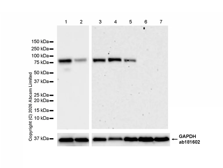 Western blot - Anti-Transglutaminase 2 antibody [RM1361] (AB325401)