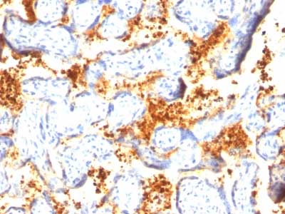 Immunohistochemistry (Formalin/PFA-fixed paraffin-embedded sections) - Anti-Transglutaminase 2 antibody [TGM2/419] (AB216018), expandable thumbnail