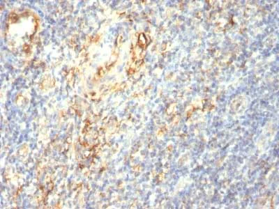 Immunohistochemistry (Formalin/PFA-fixed paraffin-embedded sections) - Anti-Transglutaminase 2 antibody [TGM2/419] (AB216018)