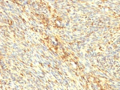 Immunohistochemistry (Formalin/PFA-fixed paraffin-embedded sections) - Anti-Transglutaminase 2 antibody [TGM2/419] (AB216018), expandable thumbnail