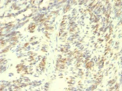 Immunohistochemistry (Formalin/PFA-fixed paraffin-embedded sections) - Anti-Transglutaminase 2 antibody [TGM2/419] (AB216018)