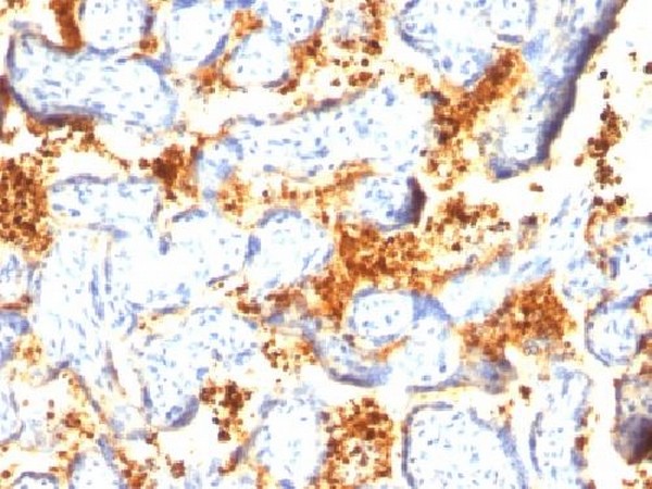 Immunohistochemistry (Formalin/PFA-fixed paraffin-embedded sections) - Anti-Transglutaminase 2 antibody [TGM2/419] - BSA and Azide free (AB212882)