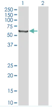 Western blot - Transglutaminase 2 overexpression 293T lysate (whole cell) (AB94220)