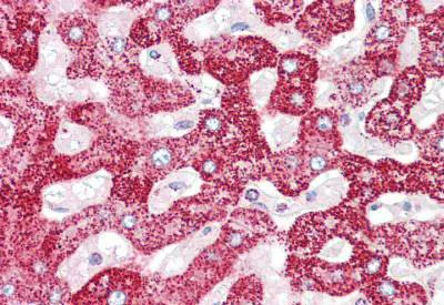 Immunohistochemistry (Formalin/PFA-fixed paraffin-embedded sections) - Anti-Transglutaminase 5/TGM5 antibody (AB133786)