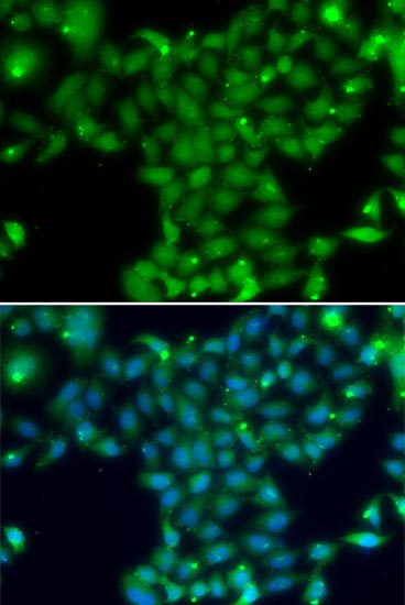 Immunocytochemistry/ Immunofluorescence - Anti-Transglutaminase 5/TGM5 antibody (AB210772)