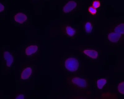 Immunocytochemistry/ Immunofluorescence - Anti-Transketolase antibody [7H1AA1] (AB112997)