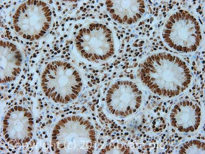 Immunohistochemistry (Formalin/PFA-fixed paraffin-embedded sections) - Anti-Transketolase antibody [7H1AA1] (AB112997)