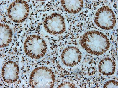 Immunohistochemistry (Formalin/PFA-fixed paraffin-embedded sections) - Anti-Transketolase antibody [7H1AA1] (AB112997)