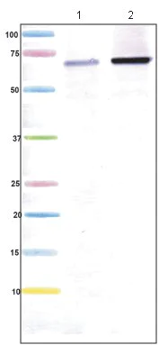 Western blot - Anti-Transketolase antibody [7H1AA1] (AB112997)