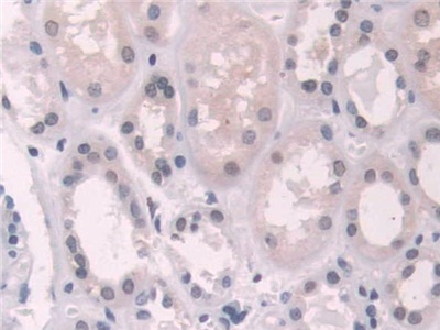 Immunohistochemistry (Formalin/PFA-fixed paraffin-embedded sections) - Anti-Transketolase antibody (ab233179), expandable thumbnail