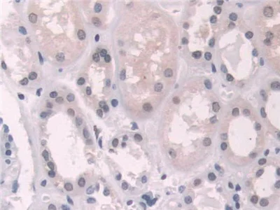 Immunohistochemistry (Formalin/PFA-fixed paraffin-embedded sections) - Anti-Transketolase antibody (AB233179)
