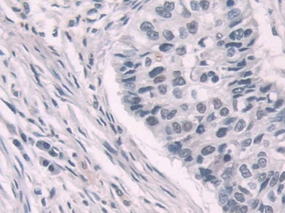 Immunohistochemistry (Formalin/PFA-fixed paraffin-embedded sections) - Anti-Transketolase antibody (ab233179), expandable thumbnail