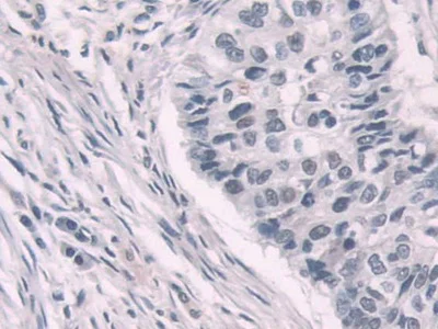 Immunohistochemistry (Formalin/PFA-fixed paraffin-embedded sections) - Anti-Transketolase antibody (AB233179)
