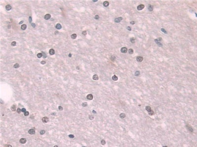 Immunohistochemistry (Formalin/PFA-fixed paraffin-embedded sections) - Anti-Transketolase antibody (AB233179), expandable thumbnail