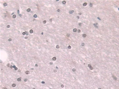 Immunohistochemistry (Formalin/PFA-fixed paraffin-embedded sections) - Anti-Transketolase antibody (AB233179)