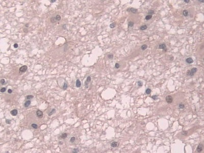 Immunohistochemistry (Formalin/PFA-fixed paraffin-embedded sections) - Anti-Transketolase antibody (AB233179), expandable thumbnail