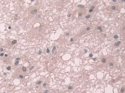 Immunohistochemistry (Formalin/PFA-fixed paraffin-embedded sections) - Anti-Transketolase antibody (AB233179)
