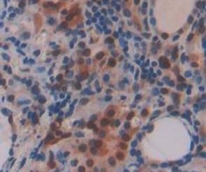 Immunohistochemistry (Formalin/PFA-fixed paraffin-embedded sections) - Anti-Transketolase antibody (AB233179), expandable thumbnail