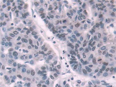 Immunohistochemistry (Formalin/PFA-fixed paraffin-embedded sections) - Anti-Transketolase antibody (ab233179), expandable thumbnail