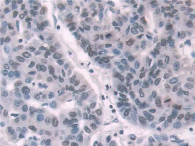 Immunohistochemistry (Formalin/PFA-fixed paraffin-embedded sections) - Anti-Transketolase antibody (AB233179)
