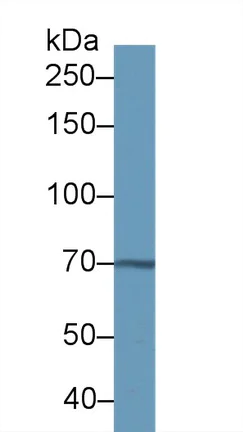 Western blot - Anti-Transketolase antibody (AB233179)