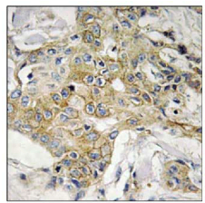 Immunohistochemistry (Formalin/PFA-fixed paraffin-embedded sections) - Anti-Transmembrane 4 L6 family member 1 antibody (AB111015)