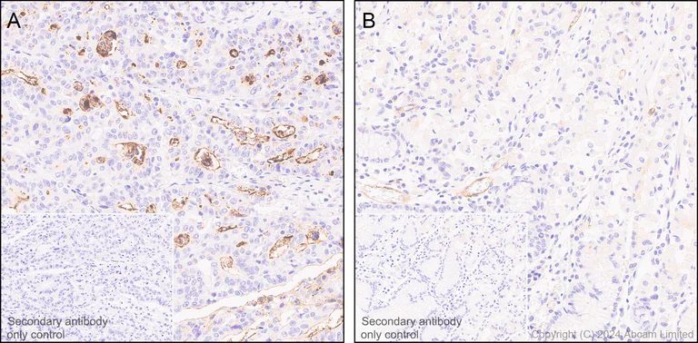 Immunohistochemistry (Formalin/PFA-fixed paraffin-embedded sections) - Anti-Transmembrane 4 L6 family member 1 antibody [EPR28894-539] (AB322342)