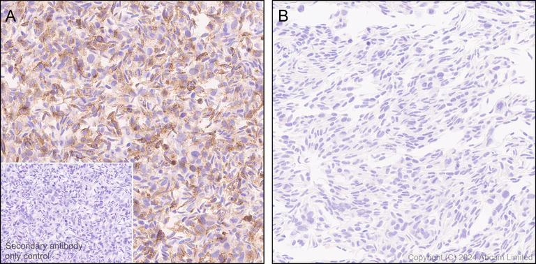 Immunohistochemistry (Formalin/PFA-fixed paraffin-embedded sections) - Anti-Transmembrane 4 L6 family member 1 antibody [EPR28894-539] (AB322342)