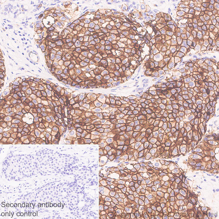 Immunohistochemistry (Formalin/PFA-fixed paraffin-embedded sections) - Anti-Transmembrane 4 L6 family member 1 antibody [EPR28894-539] (AB322342)