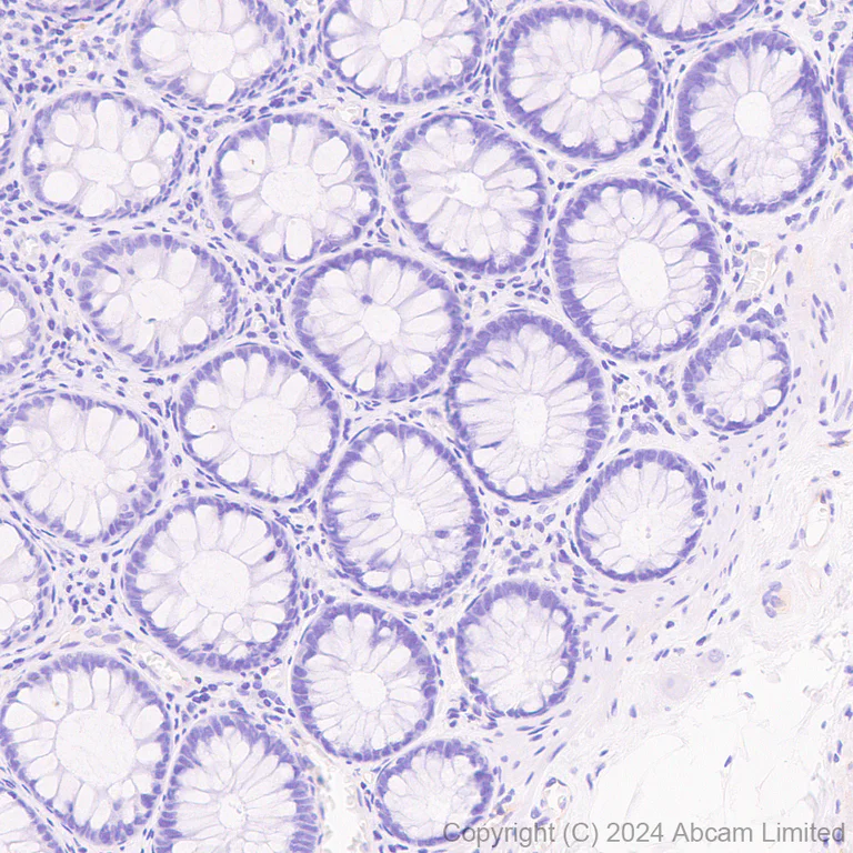 Immunohistochemistry (Formalin/PFA-fixed paraffin-embedded sections) - Anti-Transmembrane 4 L6 family member 1 antibody [EPR28894-539] (AB322342)