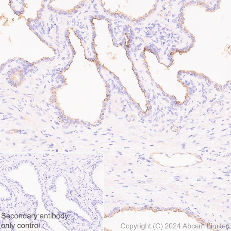 Immunohistochemistry (Formalin/PFA-fixed paraffin-embedded sections) - Anti-Transmembrane 4 L6 family member 1 antibody [EPR28894-539] (AB322342)