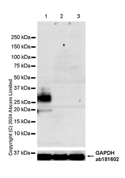 Western blot - Anti-Transmembrane 4 L6 family member 1 antibody [EPR28894-539] (AB322342)