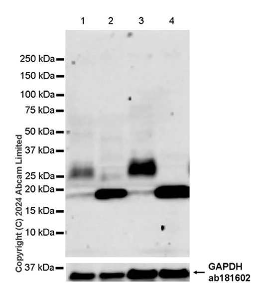 Western blot - Anti-Transmembrane 4 L6 family member 1 antibody [EPR28894-539] (AB322342)