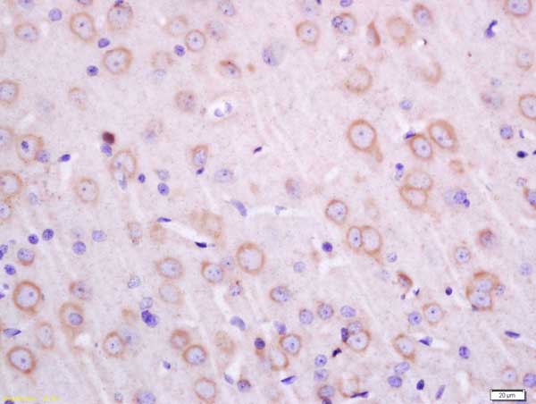 Immunohistochemistry (Formalin/PFA-fixed paraffin-embedded sections) - Anti-Transmembrane protein 30A antibody (AB217330)