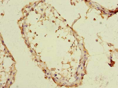 Immunohistochemistry (Formalin/PFA-fixed paraffin-embedded sections) - Anti-Transmembrane protein 93/EMC6 antibody (AB239147)