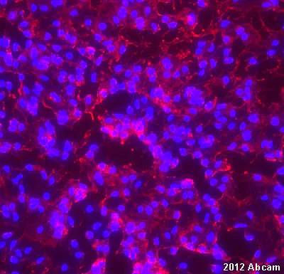 Immunocytochemistry/ Immunofluorescence - Anti-Transportin 1/MIP antibody [D45] (AB10303)