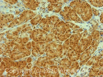 Immunohistochemistry (Formalin/PFA-fixed paraffin-embedded sections) - Anti-Transportin 1/MIP antibody [D45] (AB10303)