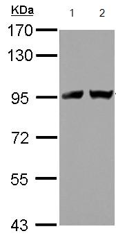 Western blot - Anti-Transportin-2 antibody (AB127165), expandable thumbnail