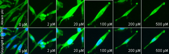 Functional Studies - TRAP-6, PAR1 agonist (AB120801), expandable thumbnail