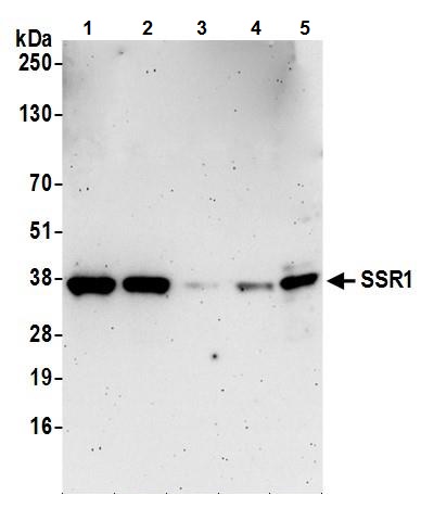 Western blot - Anti-TRAP alpha/TRAPA antibody (AB240562), expandable thumbnail