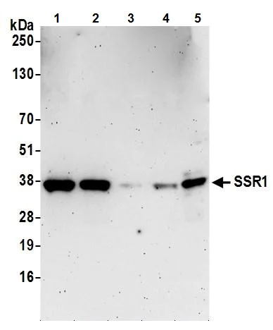 Western blot - Anti-TRAP alpha/TRAPA antibody (AB240562)