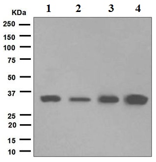Western blot - Anti-TRAP alpha/TRAPA antibody [EPR5603] (AB133238)