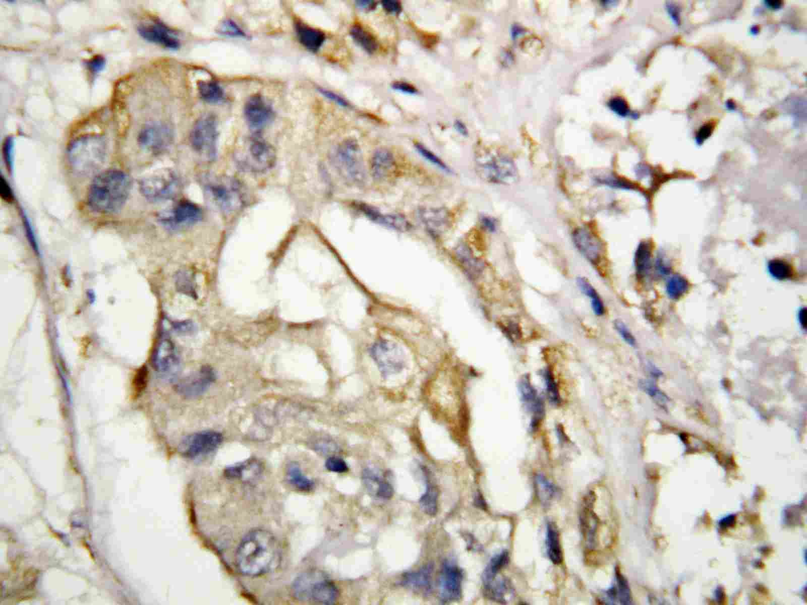 Immunohistochemistry (Formalin/PFA-fixed paraffin-embedded sections) - Anti-TRAP/CD40L antibody (AB65854), expandable thumbnail